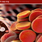 Download ASH-SAP American Society of Hematology Self-Assessment Program, 7th Edition Videos Free