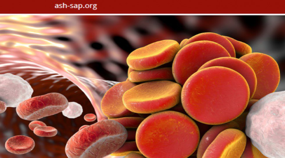 Download ASH-SAP American Society of Hematology Self-Assessment Program, 7th Edition Videos Free