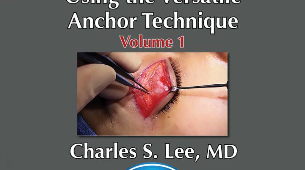 Download Asian Aesthetic Surgery Techniques, Volume 1: Asian Eyelid Surgery Using the Versatile Anchor Technique Videos Free