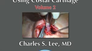 Download Asian Aesthetic Surgery Techniques, Volume 2: Asian Rhinoplasty Using Costal Cartilage Videos Free