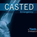 Download Continulus CASTED Emergency Orthopaedics with a Focus on Acute Musculoskeletal Injuries 2020 Videos Free