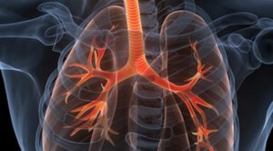 Download The Brigham Board Review and Comprehensive Update in Pulmonary Medicine 2022 Videos Free