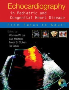 Echocardiography in Pediatric and Congenital Heart Disease PDF Free Download