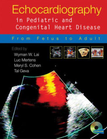 Echocardiography in Pediatric and Congenital Heart Disease PDF Free Download
