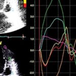 Echocardiography – A Comprehensive Review 2022 Videos Free Download