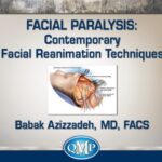 Facial Paralysis: Contemporary Facial Reanimation Techniques 2020 Videos Free Download