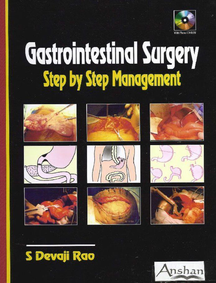 Gastrointestinal Surgery: Step by Step Management PDF Free Download