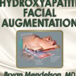 Hydroxyapatite Facial Augmentation Videos Free Download