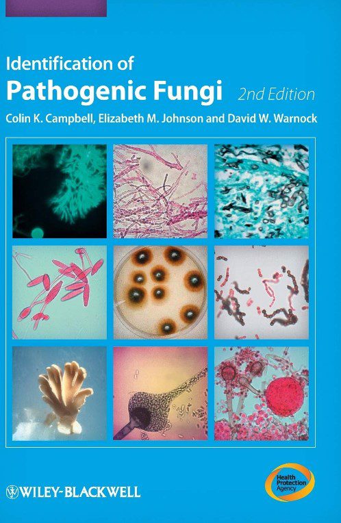 Identification Of Pathogenic Fungi 2nd Edition PDF Free Download