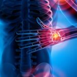 Intensive Update in Pain Management 2022 Videos Free Download