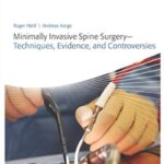 Minimally Invasive Spine Surgery - Techniques, Evidence, and Controversies PDF Free Download