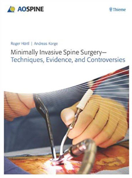 Minimally Invasive Spine Surgery - Techniques, Evidence, and Controversies PDF Free Download