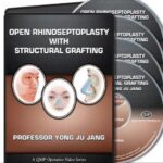 Open Rhinoseptoplasty With Structural Grafting Videos Free Download