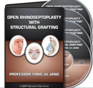 Open Rhinoseptoplasty With Structural Grafting Videos Free Download
