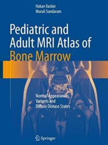 Pediatric and Adult MRI Atlas of Bone Marrow PDF Free Download