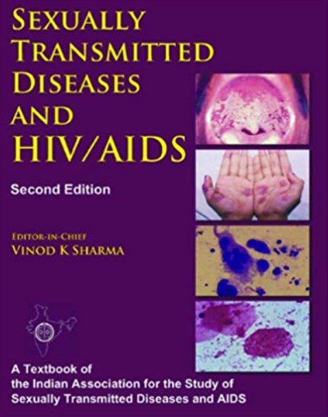 Sexually Transmitted Diseases and HIV/AIDS 2nd Edition PDF Free Download