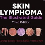 Skin Lymphoma: The Illustrated Guide 3rd Edition PDF Free Download
