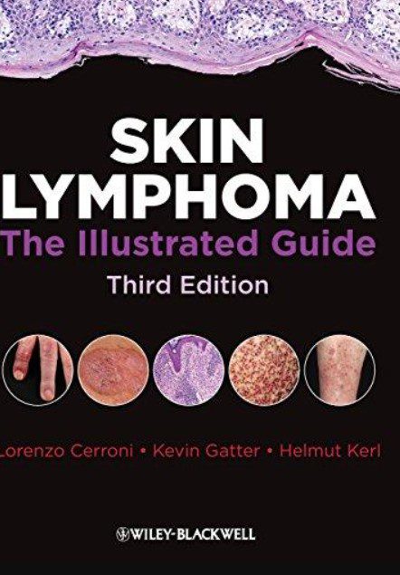 Skin Lymphoma: The Illustrated Guide 3rd Edition PDF Free Download