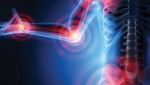 The Brigham Board Review and Comprehensive Update in Rheumatology 2022 Videos Free Download