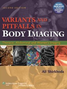 Variants and Pitfalls in Body Imaging 2nd Edition PDF Free Download