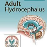 Adult Hydrocephalus PDF Free Download