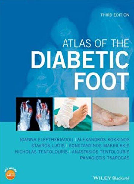 Atlas of the Diabetic Foot 3rd Edition PDF Free Download