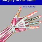 Beasley's Surgery of the Hand PDF Free Download
