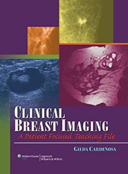 Clinical Breast Imaging: A Patient Focused Teaching File PDF Free Download