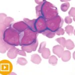 Current Concepts in Hematopathology 2022 Videos Free Download