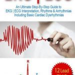 EKG ECG: An Ultimate Step-By-Step 12-Lead Guide PDF Free Download