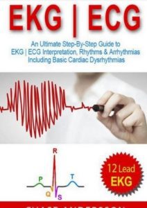 EKG ECG: An Ultimate Step-By-Step 12-Lead Guide PDF Free Download ...