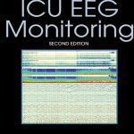 Handbook of ICU EEG Monitoring 2nd Edition PDF Free Download