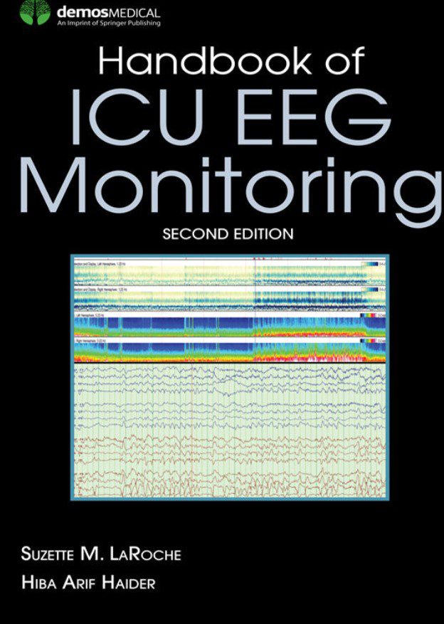 Handbook of ICU EEG Monitoring 2nd Edition PDF Free Download