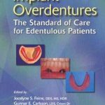 Implant Overdentures: The Standard of Care for Edentulous Patients PDF Free Download