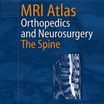 MRI Atlas Orthopedics and Neurosurgery The Spine PDF Free Download