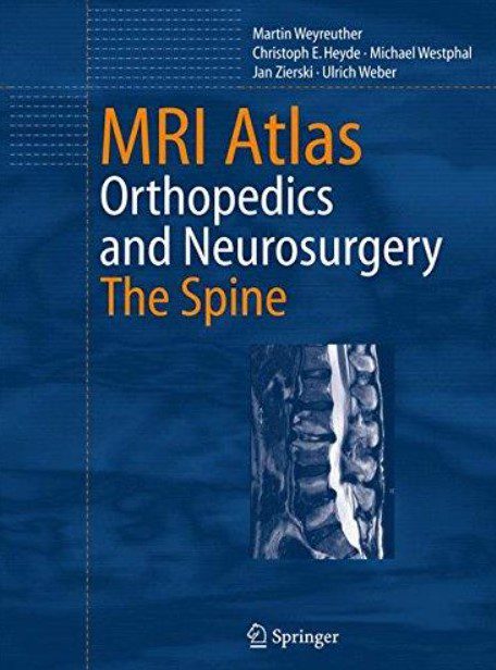 MRI Atlas Orthopedics and Neurosurgery The Spine PDF Free Download