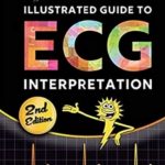 Sparkson’s Illustrated Guide to ECG PDF 2nd Edition PDF Free Download