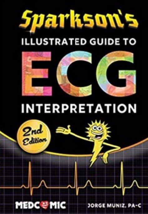 Sparkson’s Illustrated Guide to ECG PDF 2nd Edition PDF Free Download