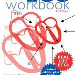The ECG Workbook 3rd Edition PDF Free Download