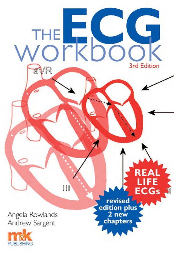 The ECG Workbook 3rd Edition PDF Free Download