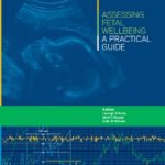 Assessing Fetal Wellbeing : A Practical Guide PDF Free Download