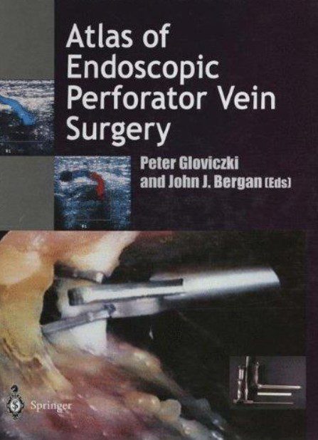 Atlas of Endoscopic Perforator Vein Surgery PDF Free Download