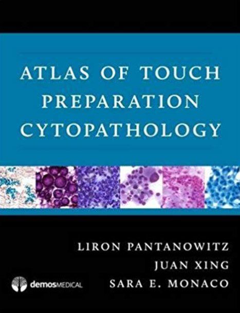 Atlas of Touch Preparation Cytopathology PDF Free Download