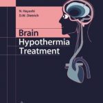 Brain Hypothermia Treatment PDF Free Download