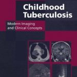 Childhood Tuberculosis: Modern Imaging and Clinical Concepts PDF Free Download