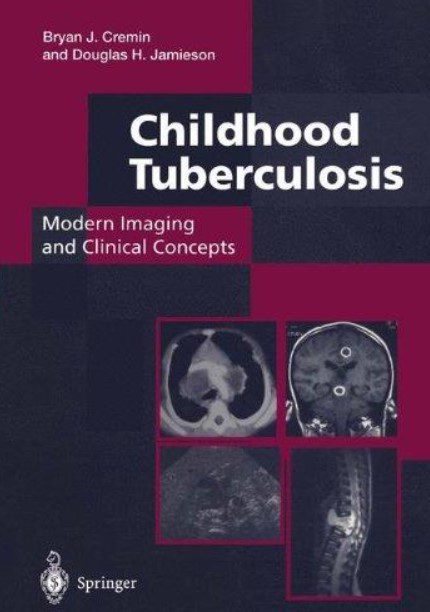 Childhood Tuberculosis: Modern Imaging and Clinical Concepts PDF Free Download