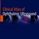 Clinical Atlas of Ophthalmic Ultrasound PDF Free Download