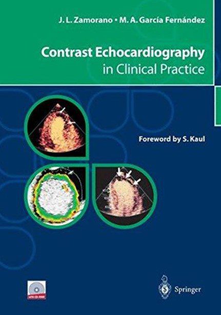 Contrast Echocardiography in Clinical Practice PDF Free Download