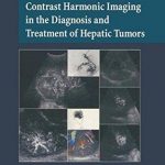 Contrast Harmonic Imaging in the Diagnosis and Treatment of Hepatic Tumors PDF Free Download