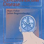 Current Review of Cerebrovascular Disease PDF Free Download